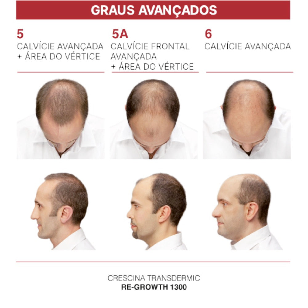 Crescina Transdermic HFSC Re-Growth 200 Homem 20 Ampolas 3.5 ml