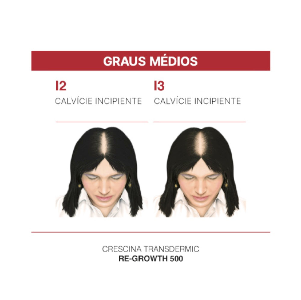 Crescina Transdermic HFSC Tratamento Completo 1300 Mulher 20 Ampolas 3.5 ml