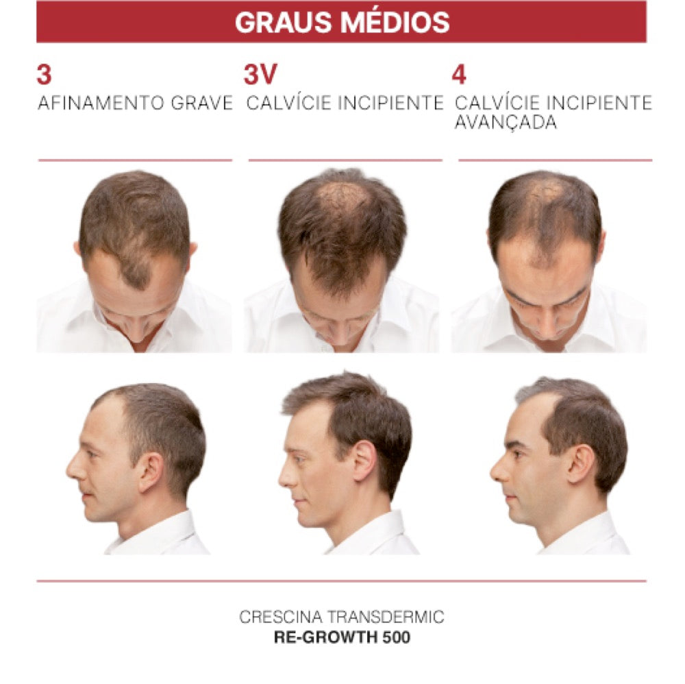 Crescina Transdermic HFSC Re-Growth 1300 Homem 20 Ampolas 3.5 ml